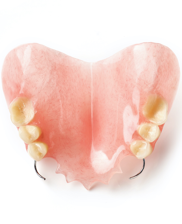 Wisdom Tooth Surgery