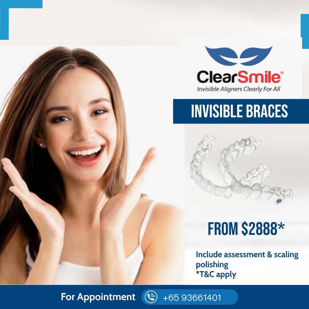 best invisible braces